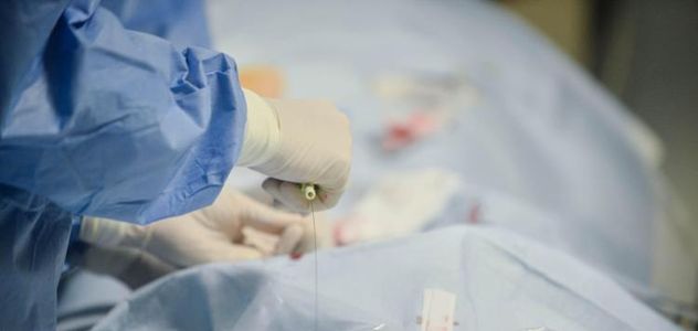 Con nuova tecnica chirurgica anti-obesità si riduce lo stomaco senza tagli e cicatrici