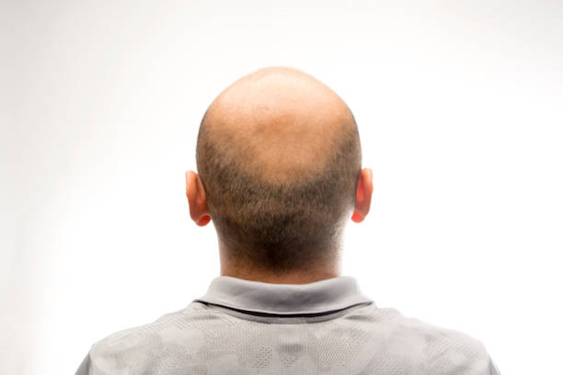 Arrestato barbiere pusher: a far insospettire i troppi clienti calvi