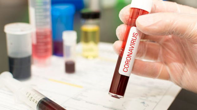 Paziente sardo positivo al Coronavirus: è in quarantena in Lombardia