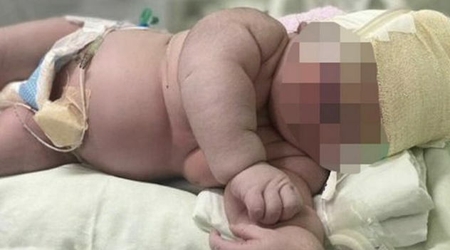 Parto da record: nasce bimbo gigante di 7 chili e mezzo