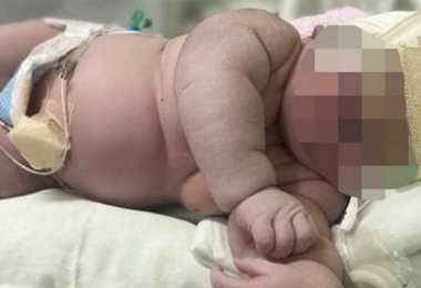 Parto da record: nasce bimbo gigante di 7 chili e mezzo