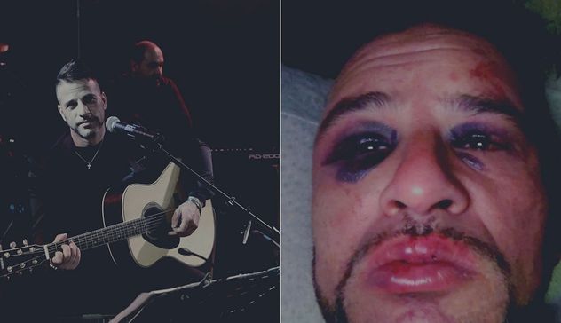 Sassari: il cantante Luca Tilocca pestato a sangue fuori da un locale