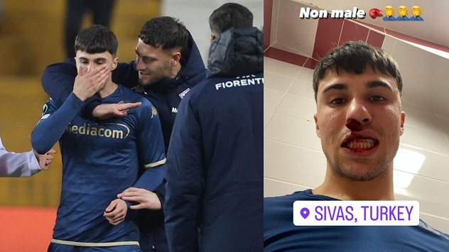 Fiorentina, Bianco colpito da un pugno da invasore di campo durante match con Sivasspor