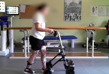 Milano, 32enne paralizzata torna a camminare dopo 5 anni