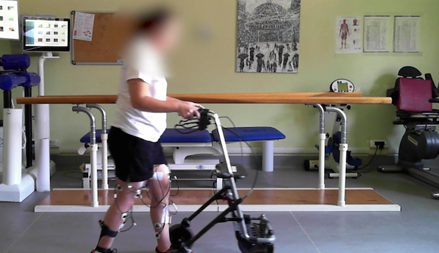 Milano, 32enne paralizzata torna a camminare dopo 5 anni