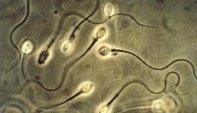 Covid, effetto virus sui maschi: anche dopo 3 mesi meno spermatozoi e più lenti