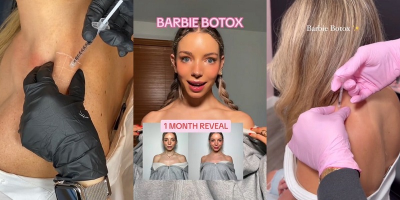 Barbie botox: cos'è, risultati e rischi di questo trattamento