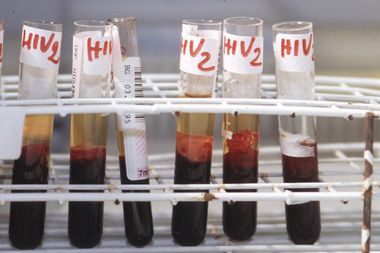 Aids: Iss, casi Hiv tornano a salire dopo 10 anni, un terzo diagnosi in over 50