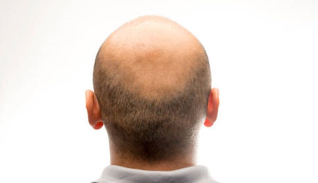 Arrestato barbiere pusher: a far insospettire i troppi clienti calvi