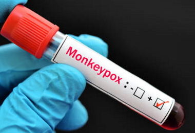 Vaiolo scimmie, parte lunedì la campagna di vaccinazione 
